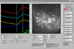 NeuroPlex imaging software